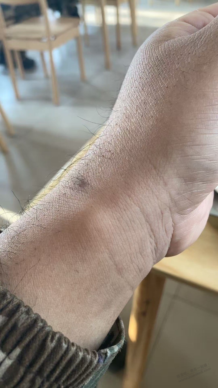 这是不是玩手机玩多了