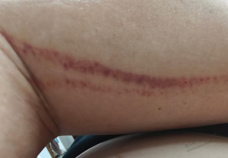 结婚六年了 ,被家暴了十多次,今天我终于还手,把我对象打了,我忍了六年了 结婚六年了 ,被家暴了十多次,今天我终于还手,把我对象打了,我忍了六年了